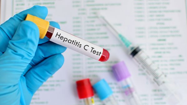 A fost lansată testarea de screening la hepatitele virale B și C cu Teste Rapide de Diagnostic