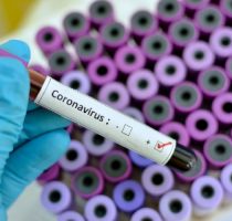 Ministerul Sănătății vine cu precizări în legătură cu realizarea testelor de diagnostic PCR  pentru COVID-19 în laboratoarele publice