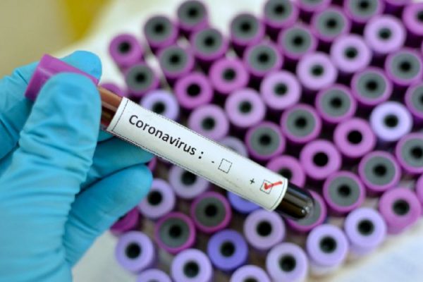 Laboratorul din Germania a confirmat prezența tulpinii Delta a virusului SARS-CoV-2 în Republica Moldova