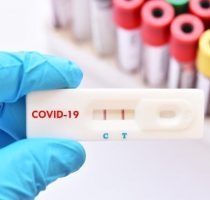Alte 100.000 teste rapide de diagnostic pentru detectarea Ag SARSCoV-2 au fost achiziționate și urmează să fie distribuite instituțiilor medicale
