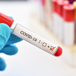 Число новых случаев заболеваний COVID-19 остается низким