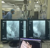 Viața unui tânăr a fost salvată de medicii de la Institutul de Medicină Urgentă